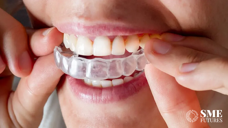 India clear aligners market on rise